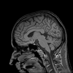 MRI Template - T1 Sagittal View